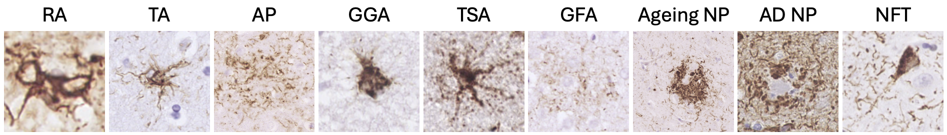 High magnification examples